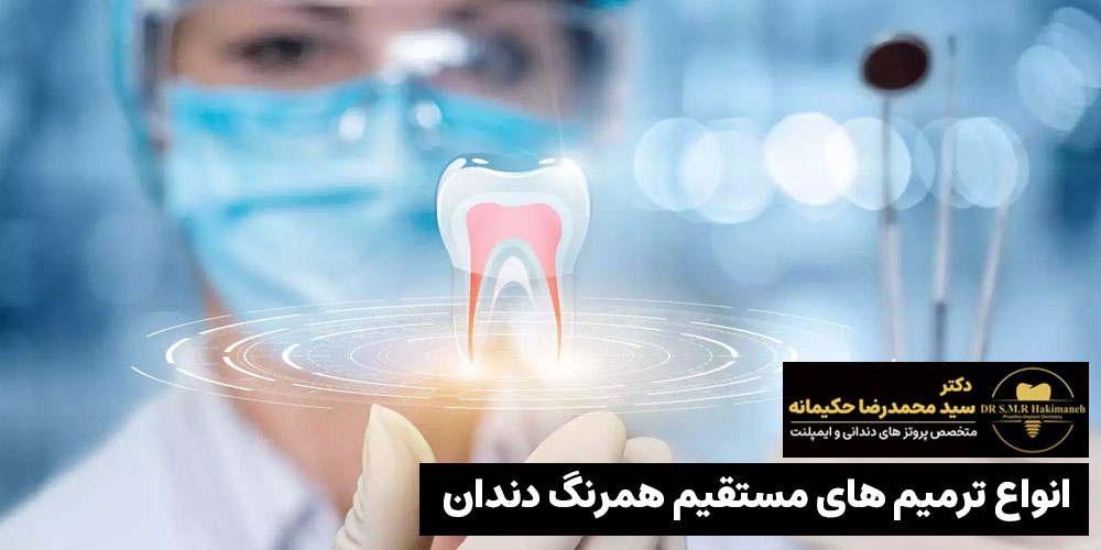 خدمات ترمیم دندان در اصفهان (انواع ترمیم های مستقیم همرنگ دندان)