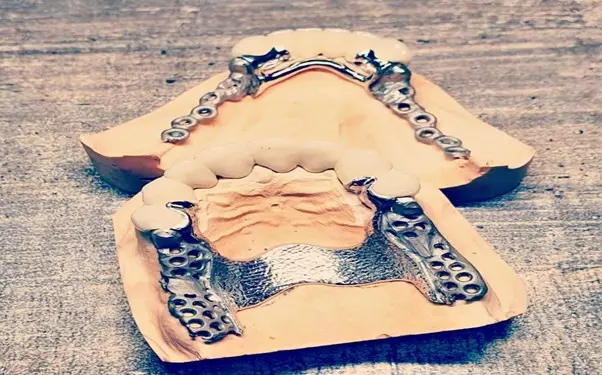 مزایای پروتز پارسیل کروم کبالت