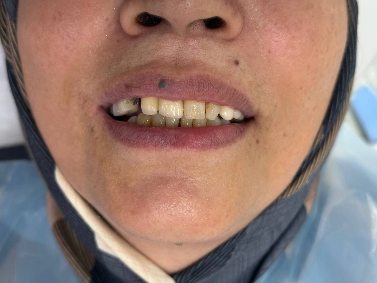 نمونه درمانی شش قبل