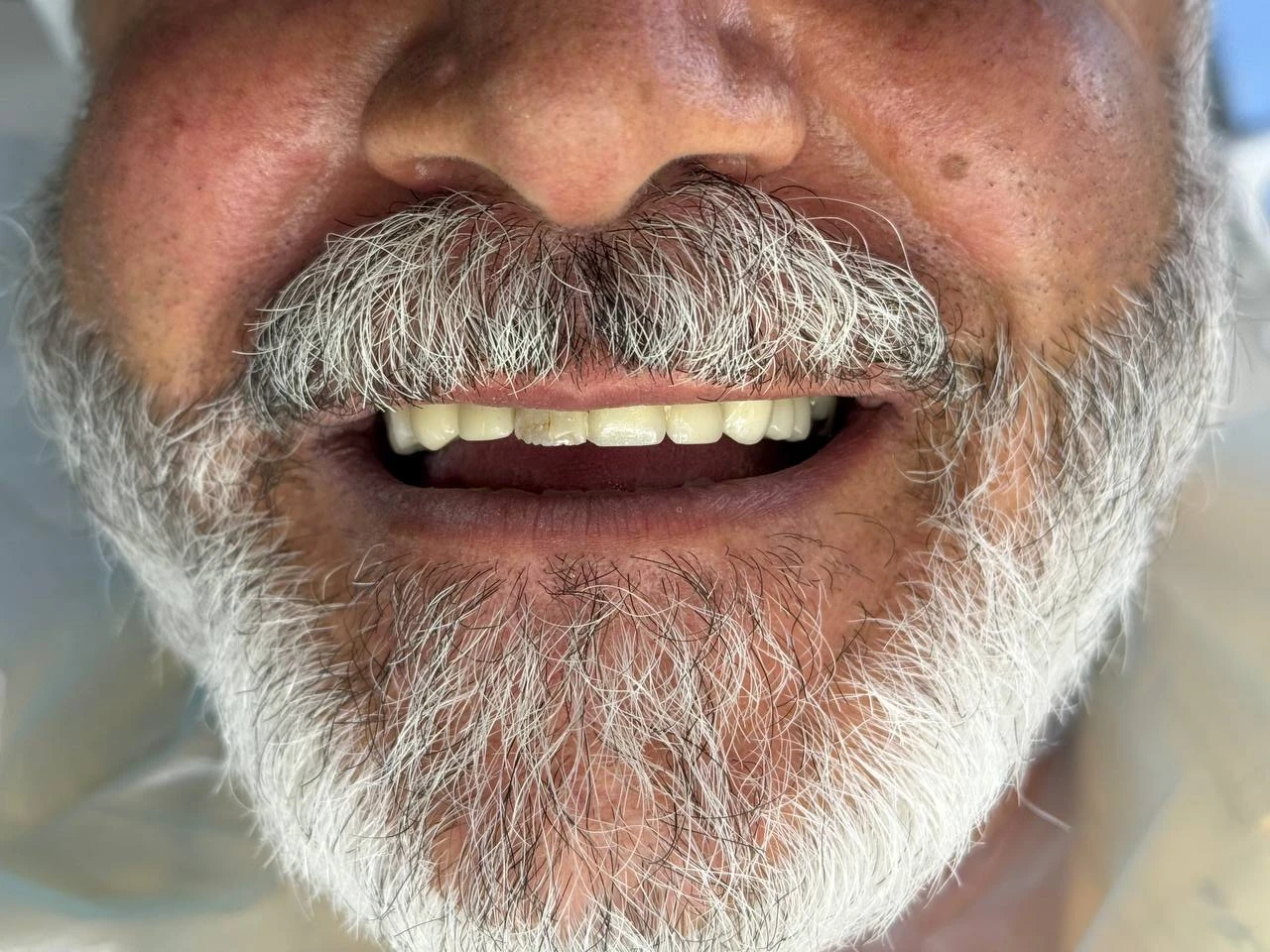 نمونه درمانی دو بعد