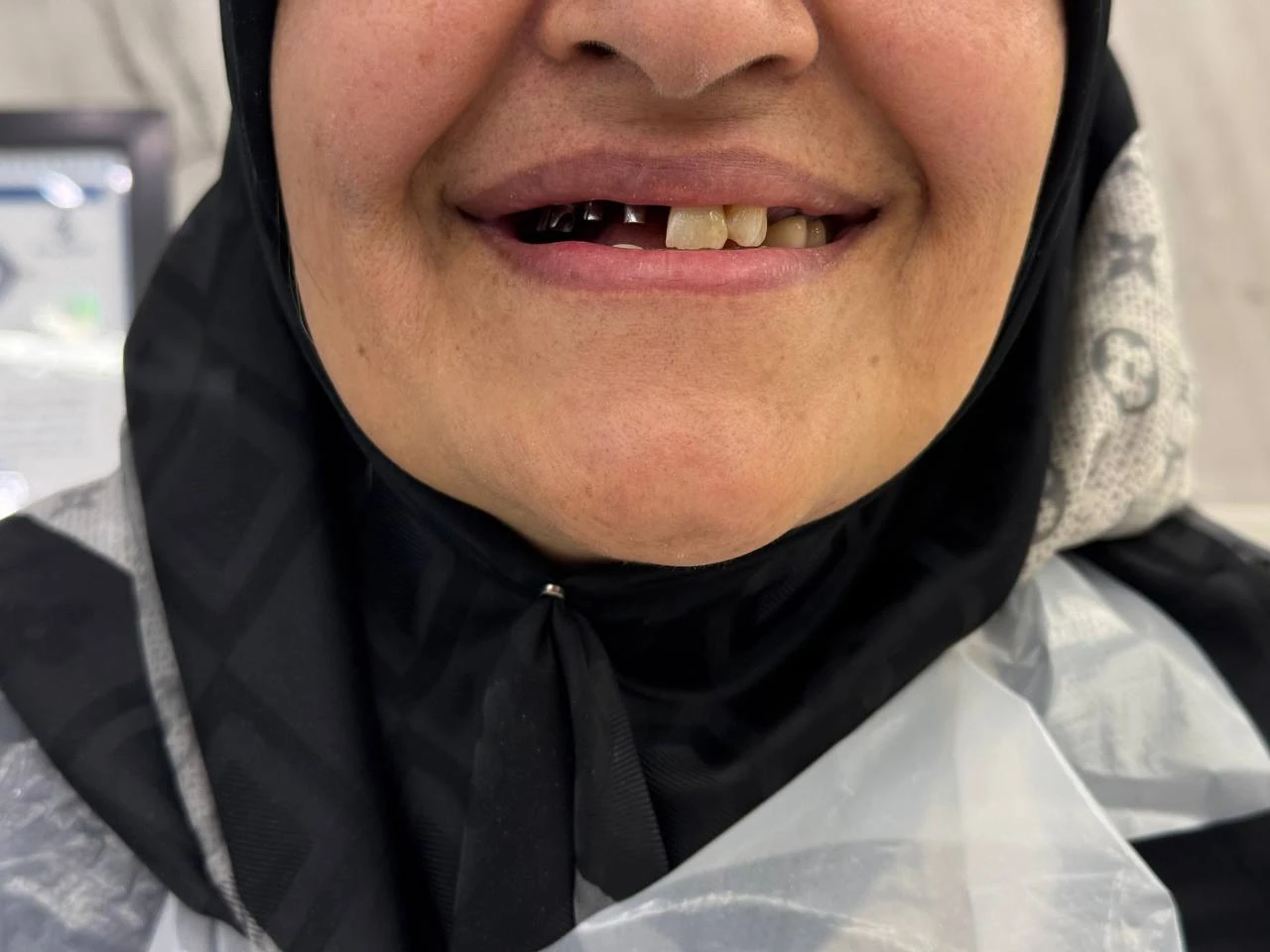 نمونه درمانی یک قبل
