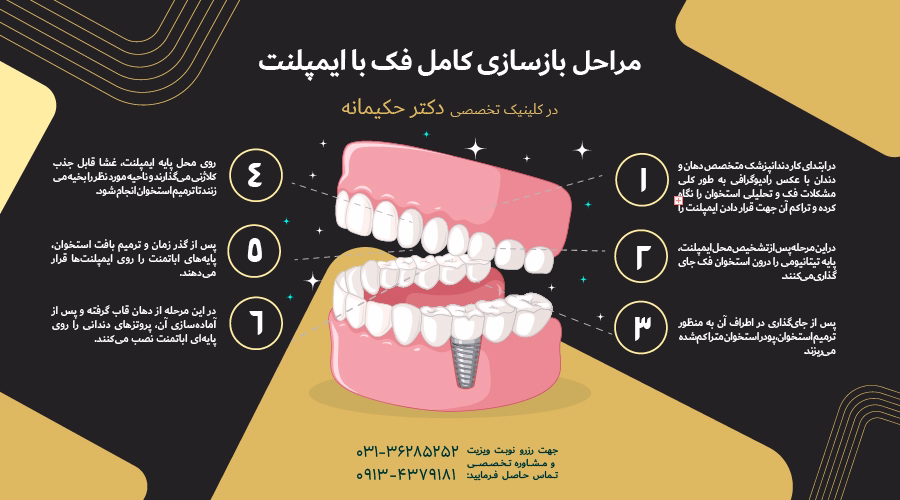 مراحل بازسازی کامل فک با ایمپلنت