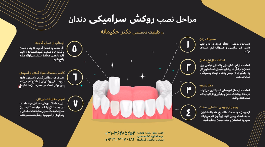مراحل نصب روکش سرامیکی دندان