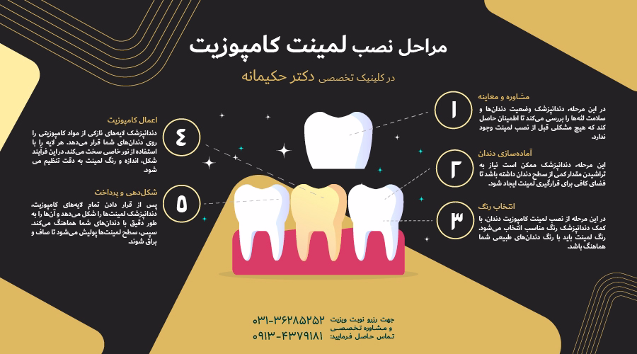مراحل نصب لمینت کامپوزیت