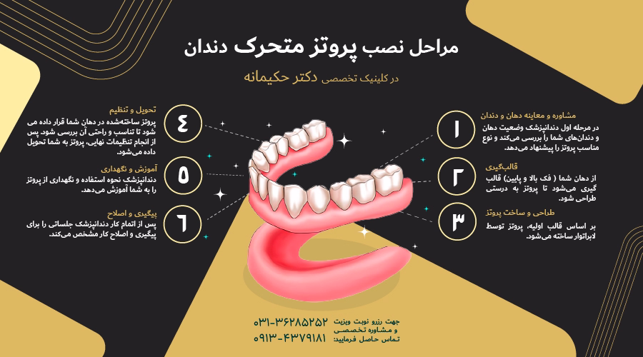مراحل نصب پروتز متحرک دندان