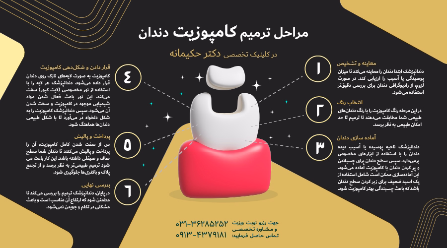مراحل ترمیم کامپوزیت دندان
