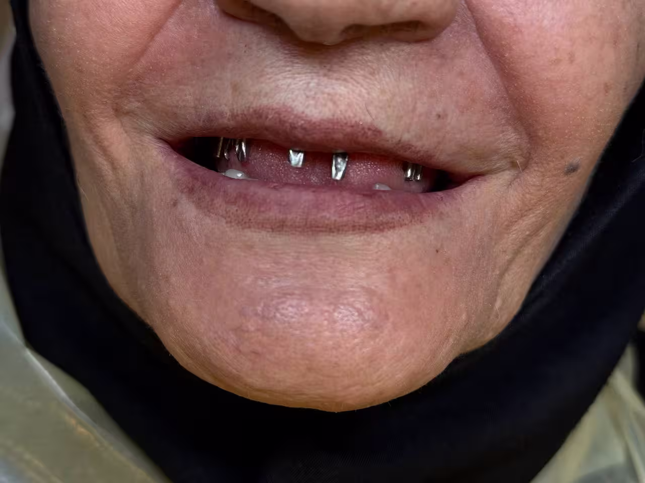 قبل