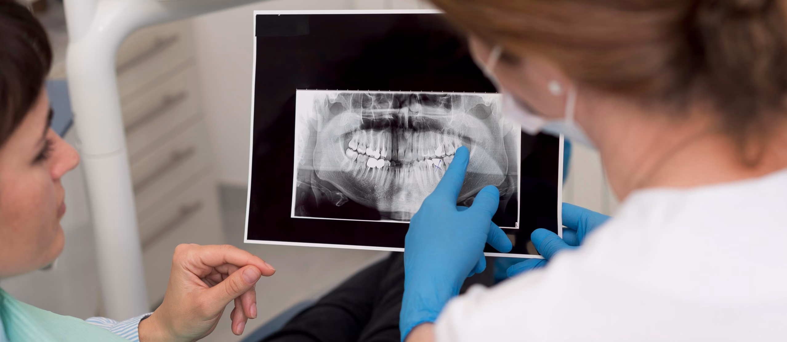 مقایسه دقت عکس OPG و CBCT