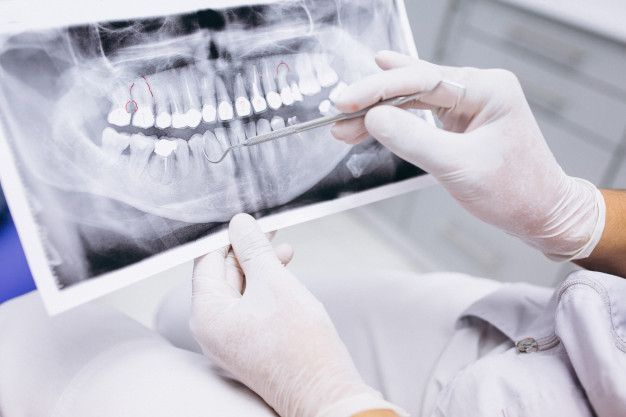 مزایای CBCT