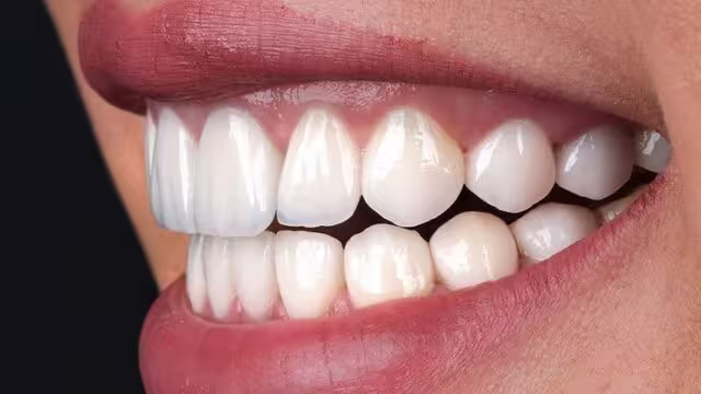 تفاوت روکش ایمکس و زیرکونیا