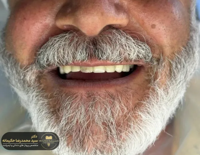 بعد