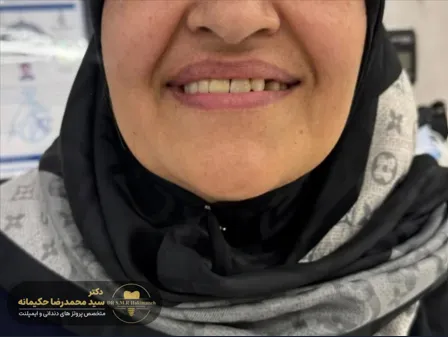 بعد