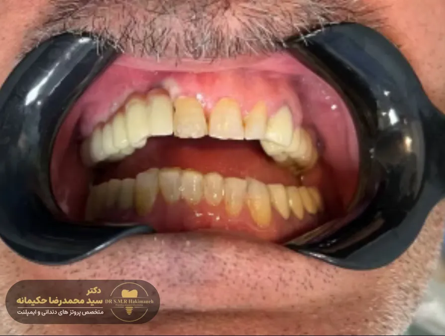 بعد