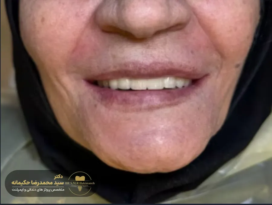 بعد