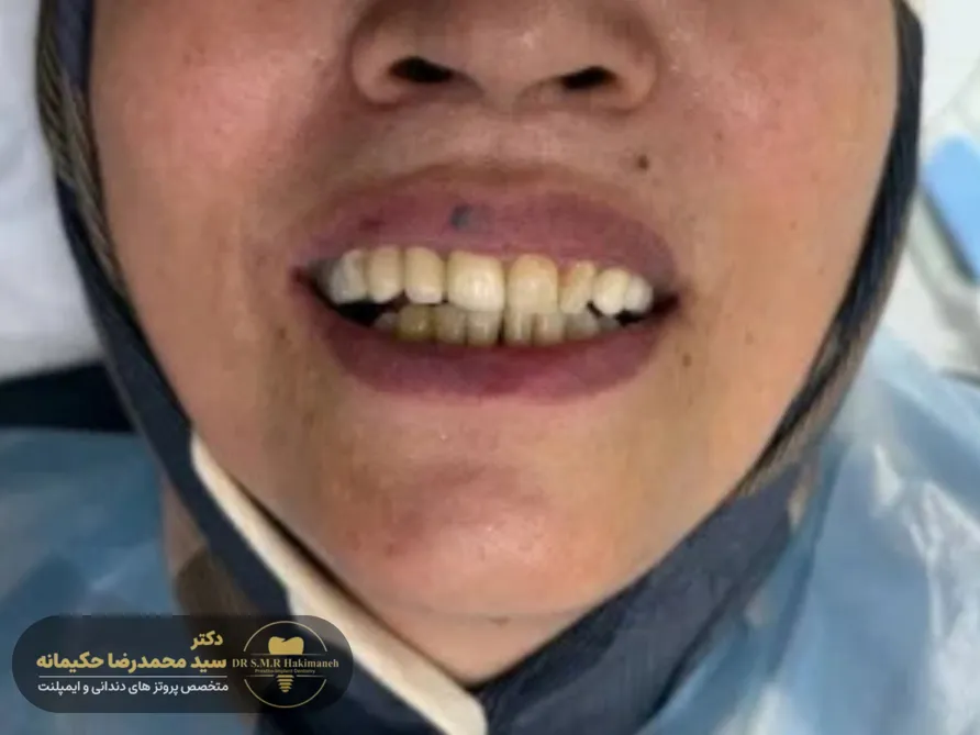 بعد