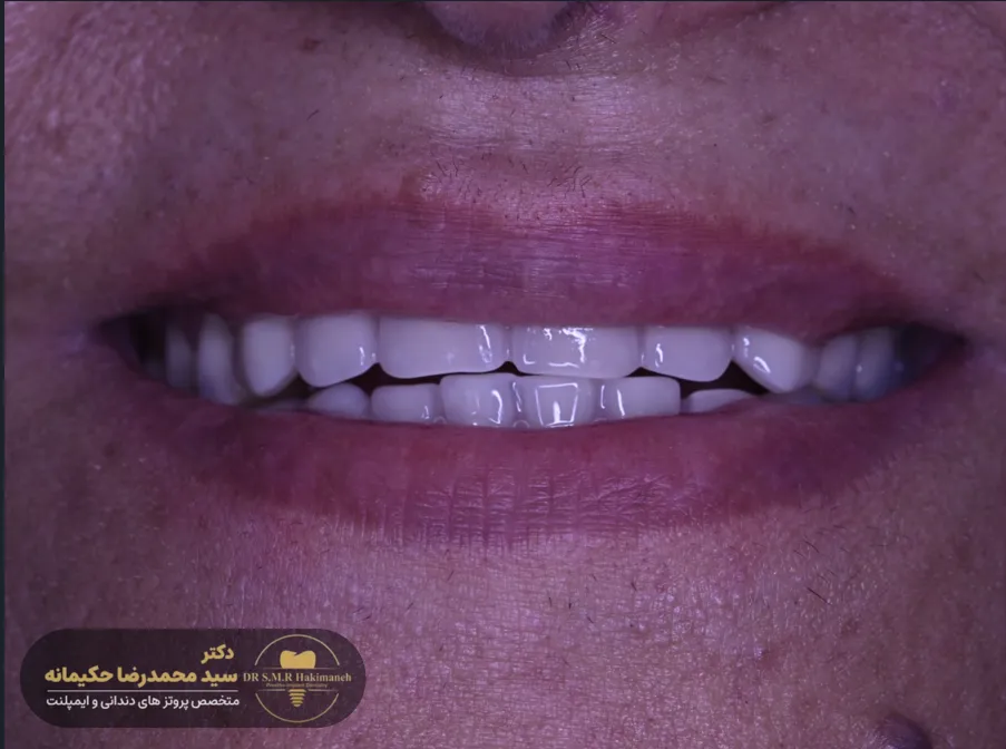 بیمار 13 بعد