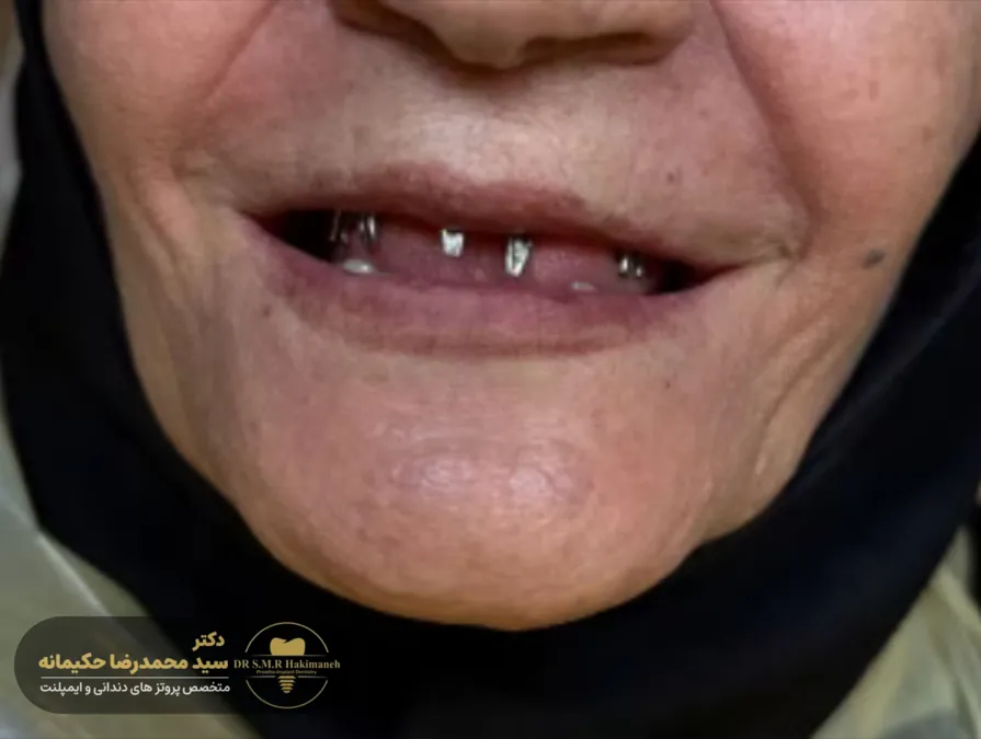 قبل