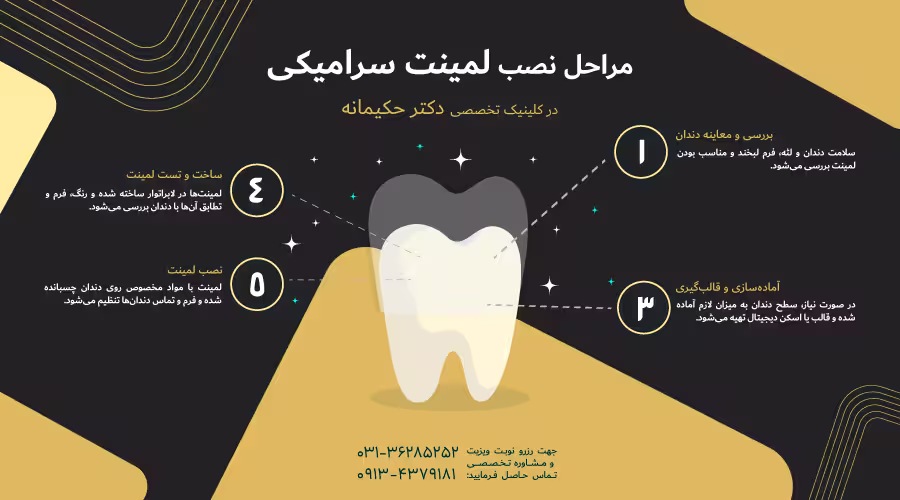 مراحل نصب لمینت سرامیکی
